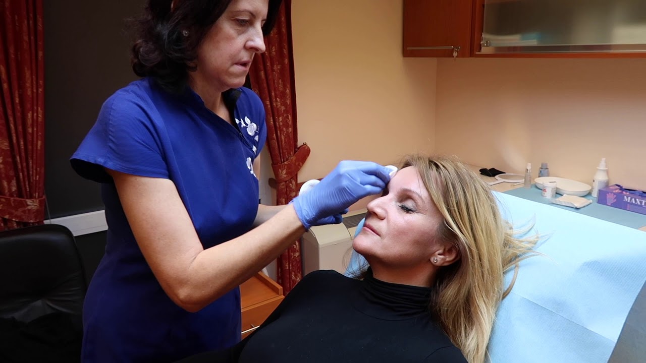 ARCFIATALÍTÁS 1. rész - BOTOX kezelés