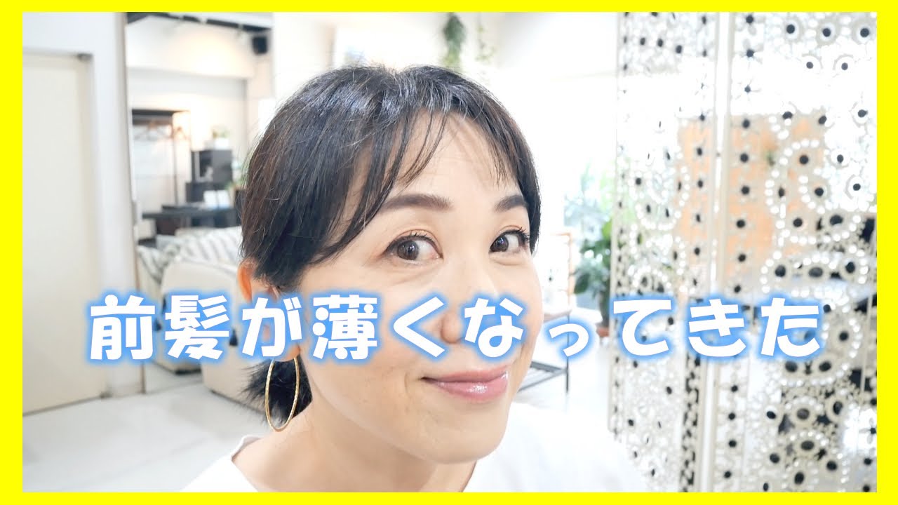 【前髪の薄毛が気になる方】お悩み解決