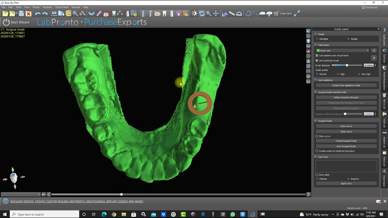 Blue Sky Bio, CBCT implant planning, (Part 6) Guide Design, Dr Khaled Ekram ( Arabic )