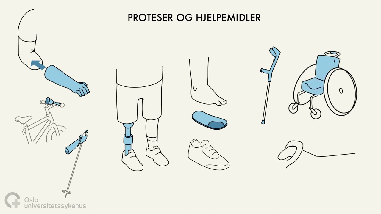 Veiledning for dysmelibehandling