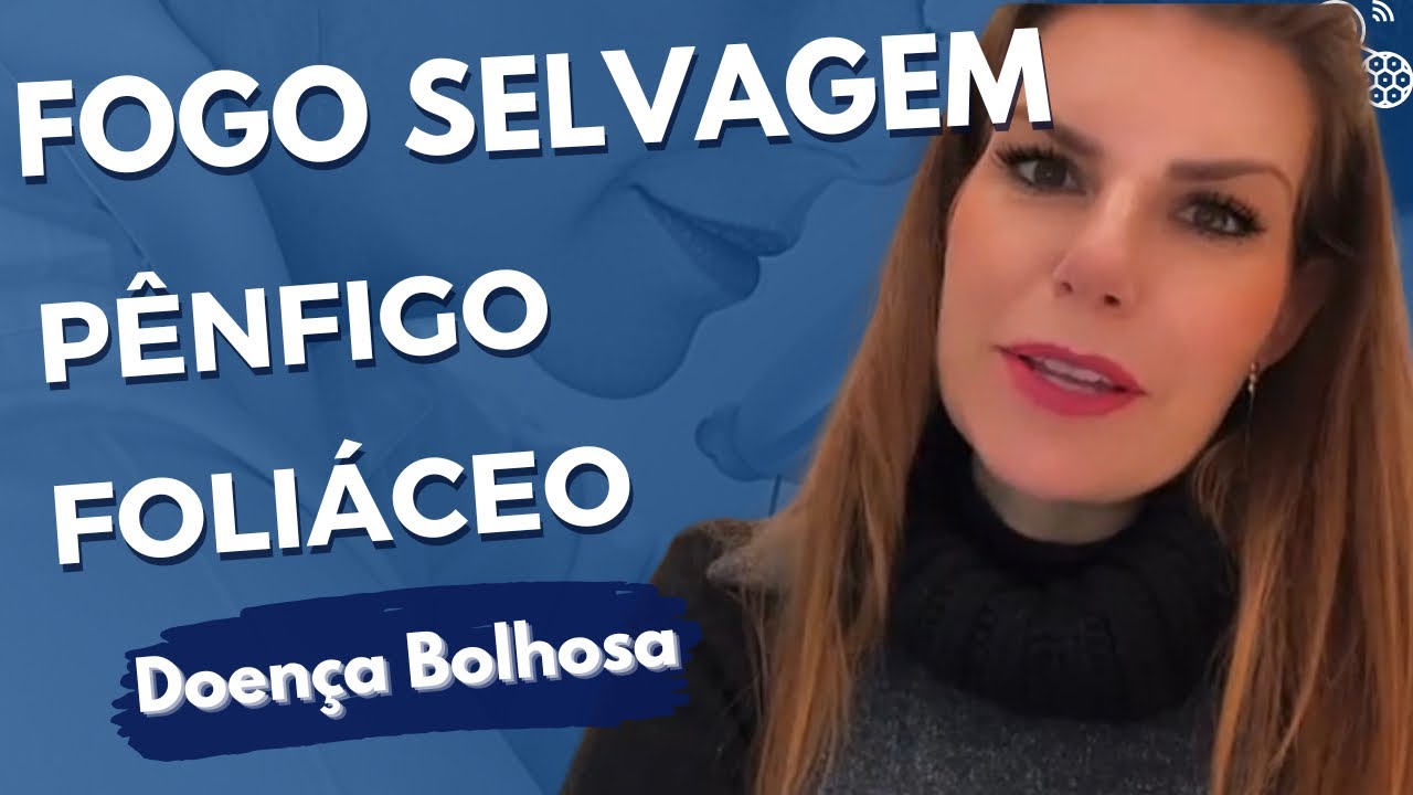 Fogo Selvagem - o que é e como tratar o pênfigo foliáceo