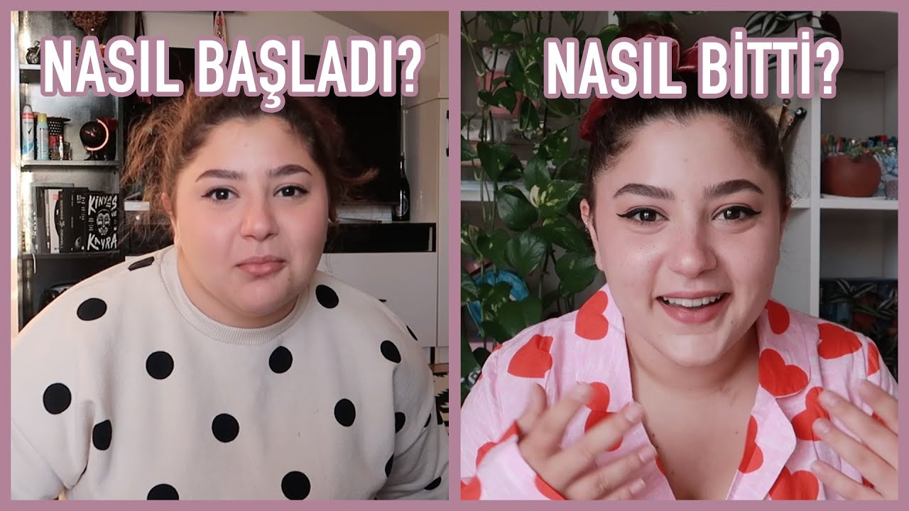 MİDE BALONUM ÇIKTI! | toplam kaç kilo verdim?