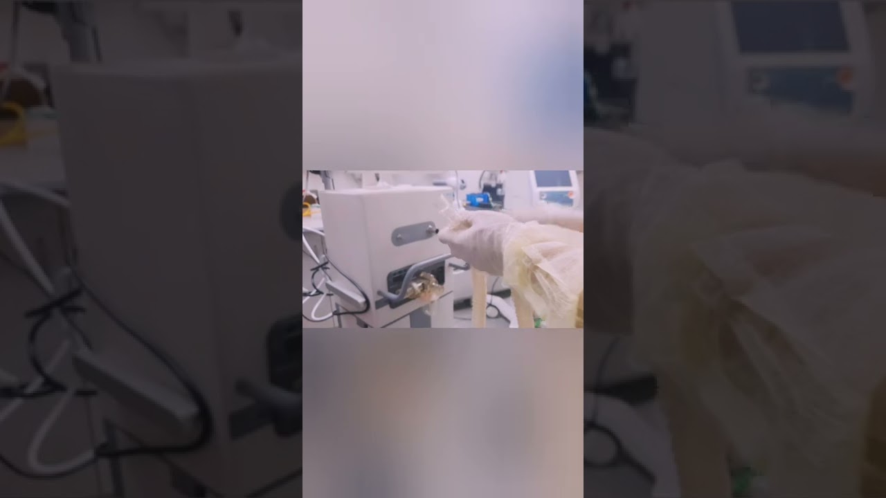 MEKICS SU: MV2000 VENTILATOR PRE-USE CHECK AND CALIBRATION