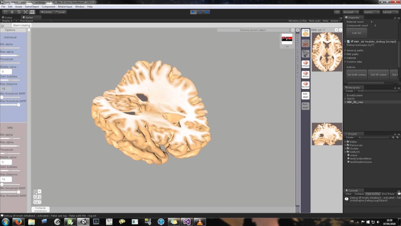 UNITY : 3D realtime brain cuts