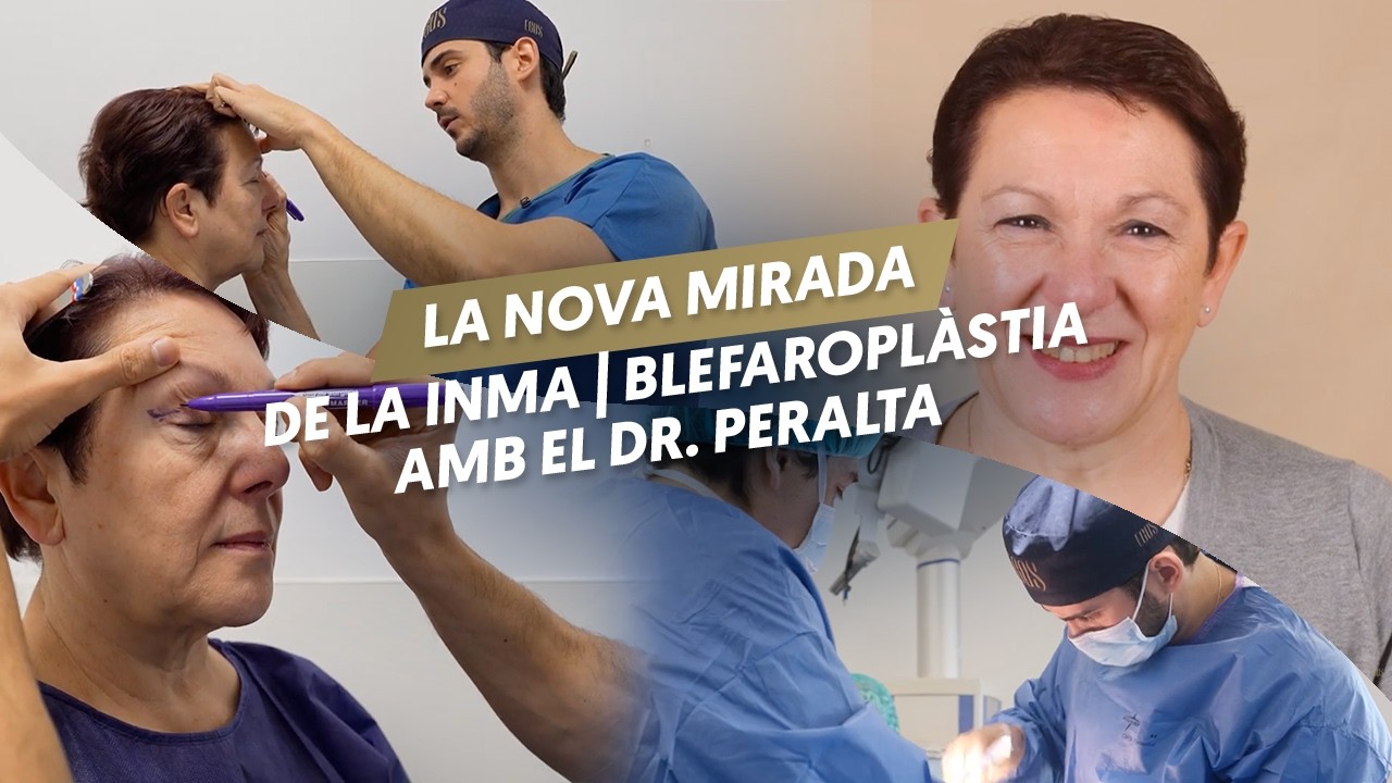 ✨Blefaroplàstia amb el Dr. Peralta | La nova mirada de la Inma