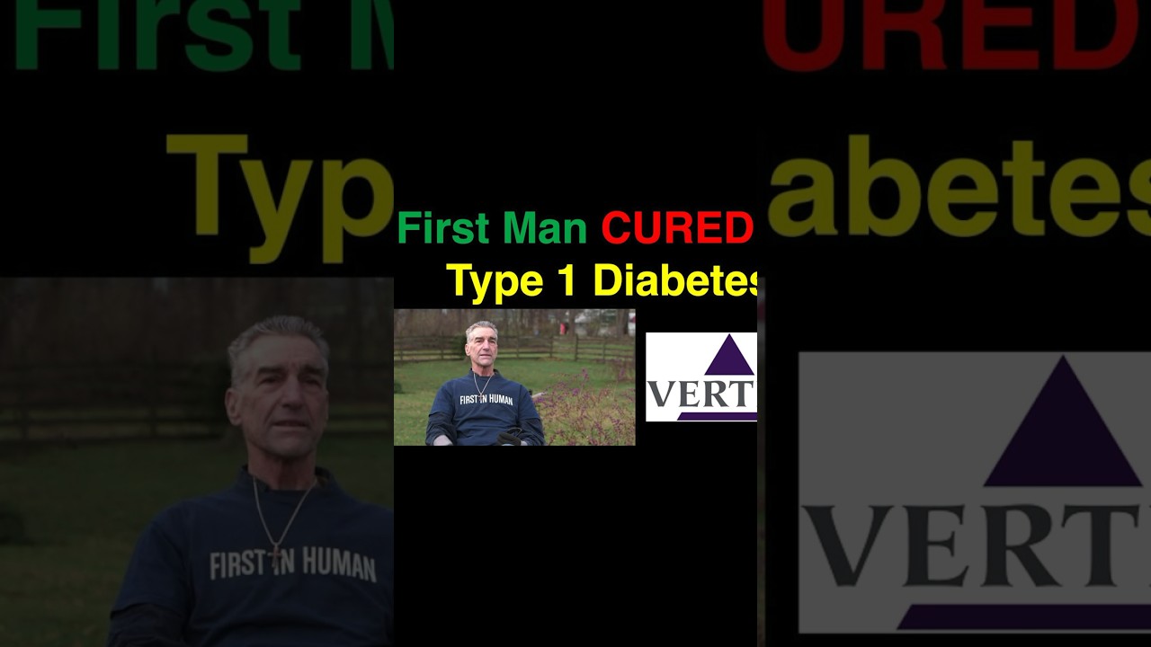 A stem cell therapy has cured type 1 diabetes. Do you think a cure is coming? #t1d #diabetes