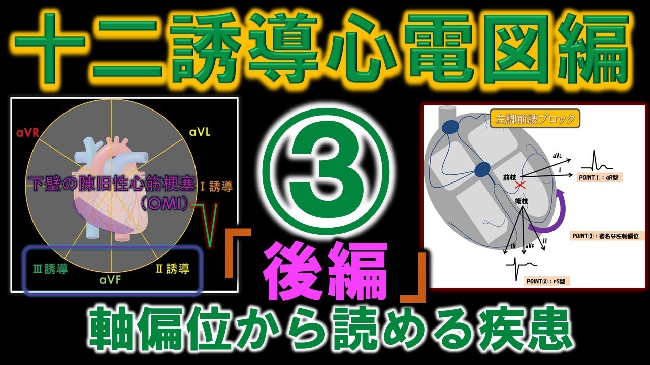 (後編)：軸偏位から読める疾患(左脚前肢ブロック、左脚後肢ブロックが分かります)
