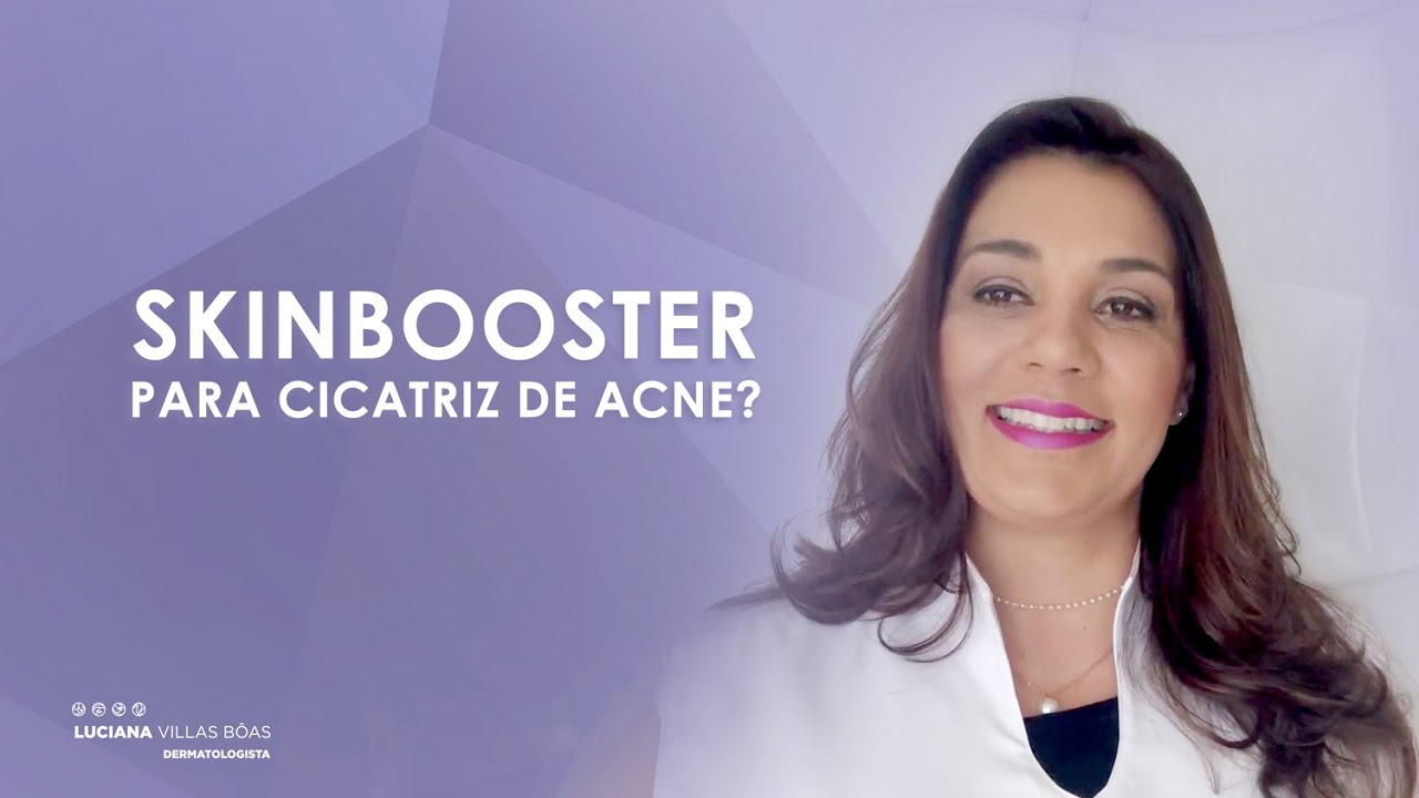 Skinbooster é um tratamento para cicatriz de acne?