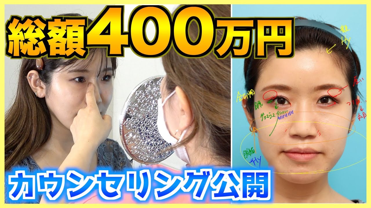 【整形】総額400万の整形で顔面をカスタムします！