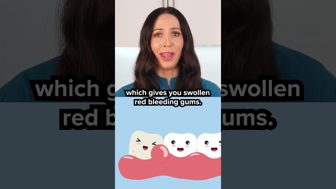 does scaling teeth damage your gums? #shorts