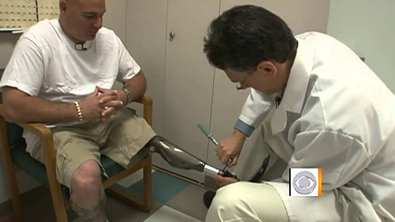 Bionic leg for soldiers helping civilian amputees