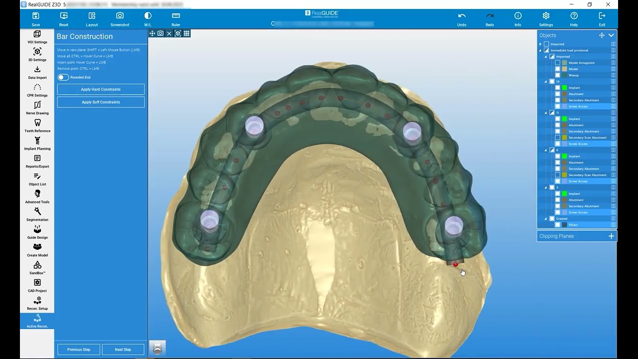 RealGUIDE Software: Reconstruction Setup- Part 3