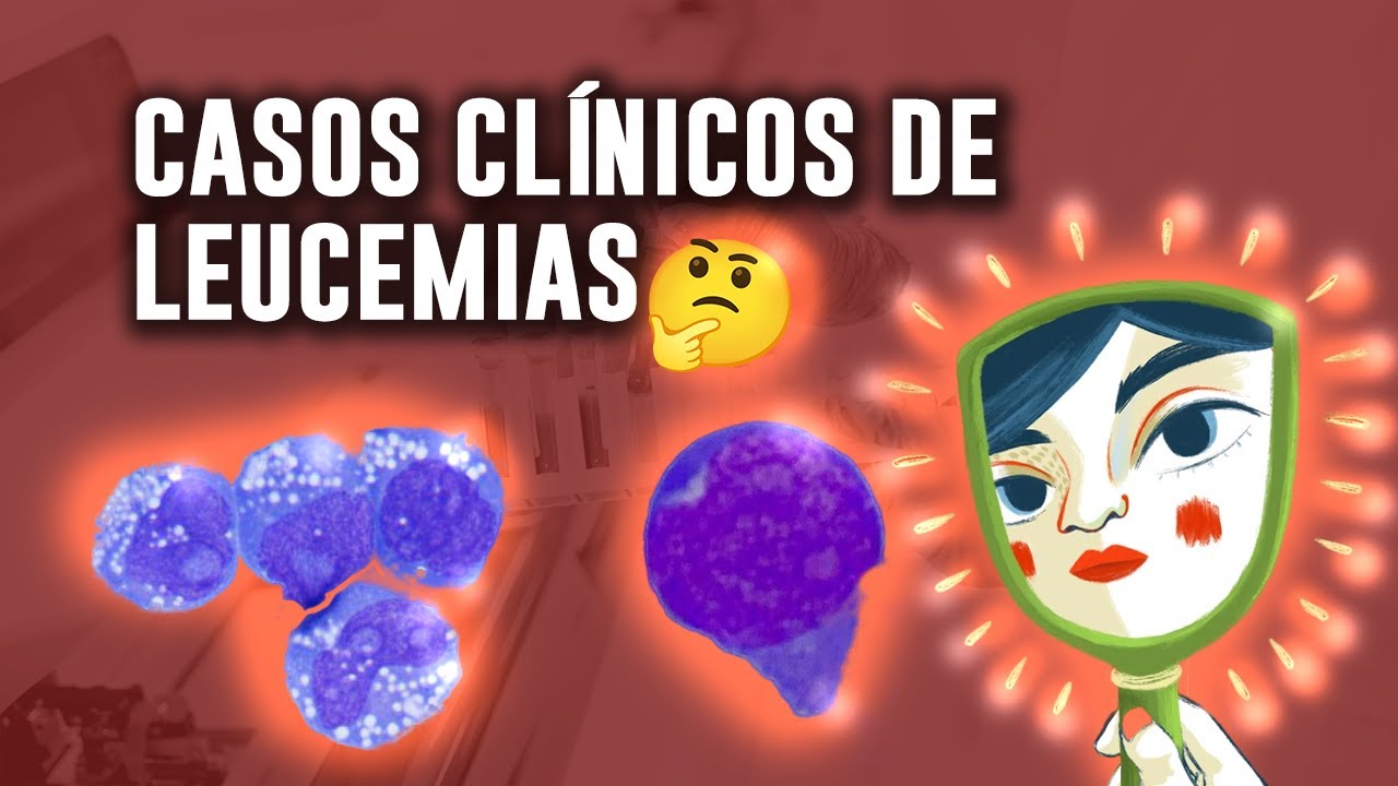 ¿Cómo se observan los FROTIS de SANGRE de pacientes con LEUCEMIA? | Casos y células encontradas