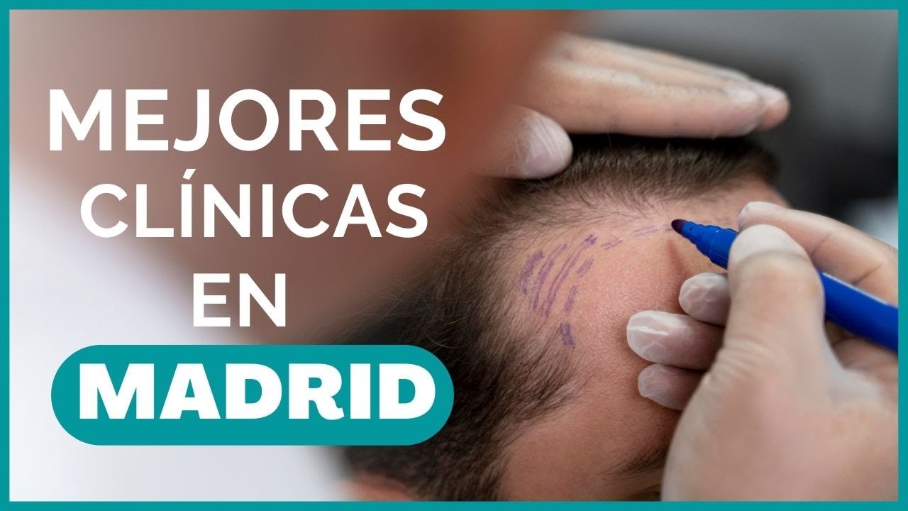 MEJOR CLÍNICA de INJERTO CAPILAR en MADRID / Opiniones y Resultados /Capilclinic, Medilor, Dr. Couto