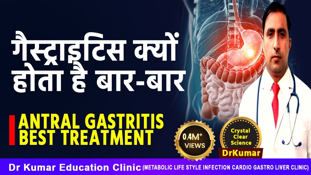 EROSIVE ANTRAL GASTRITIS ||CAUSES  / TREATMENT  / PREVENTION  / Dr Kumar education clinic