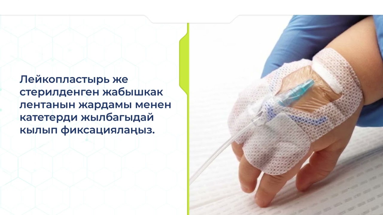Ымыркай балдардын перифериялык веналарына катетер коюу