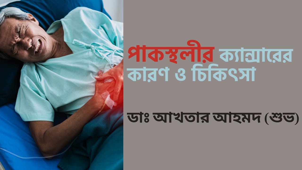 পাকস্থলীর ক্যান্সারের কারণ ও চিকিৎসা | Stomach cancer causes and treatment