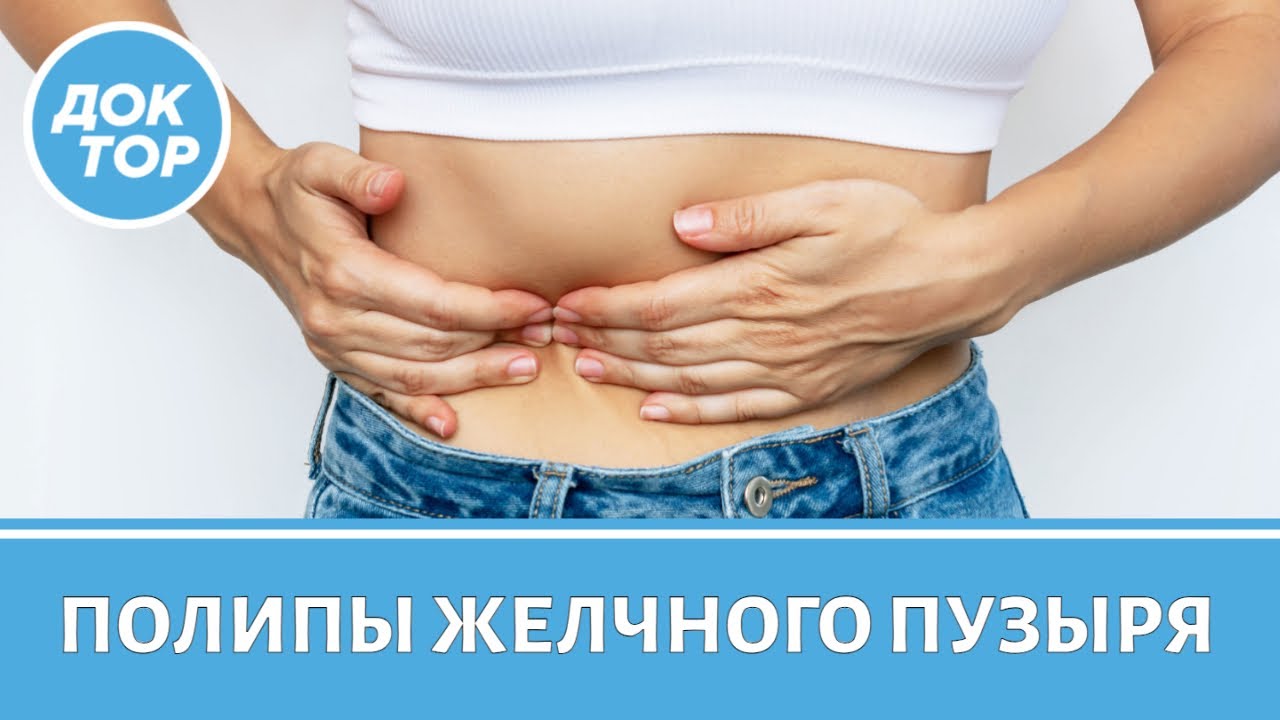 Полипы желчного пузыря: симптомы, лечение, профилактика
