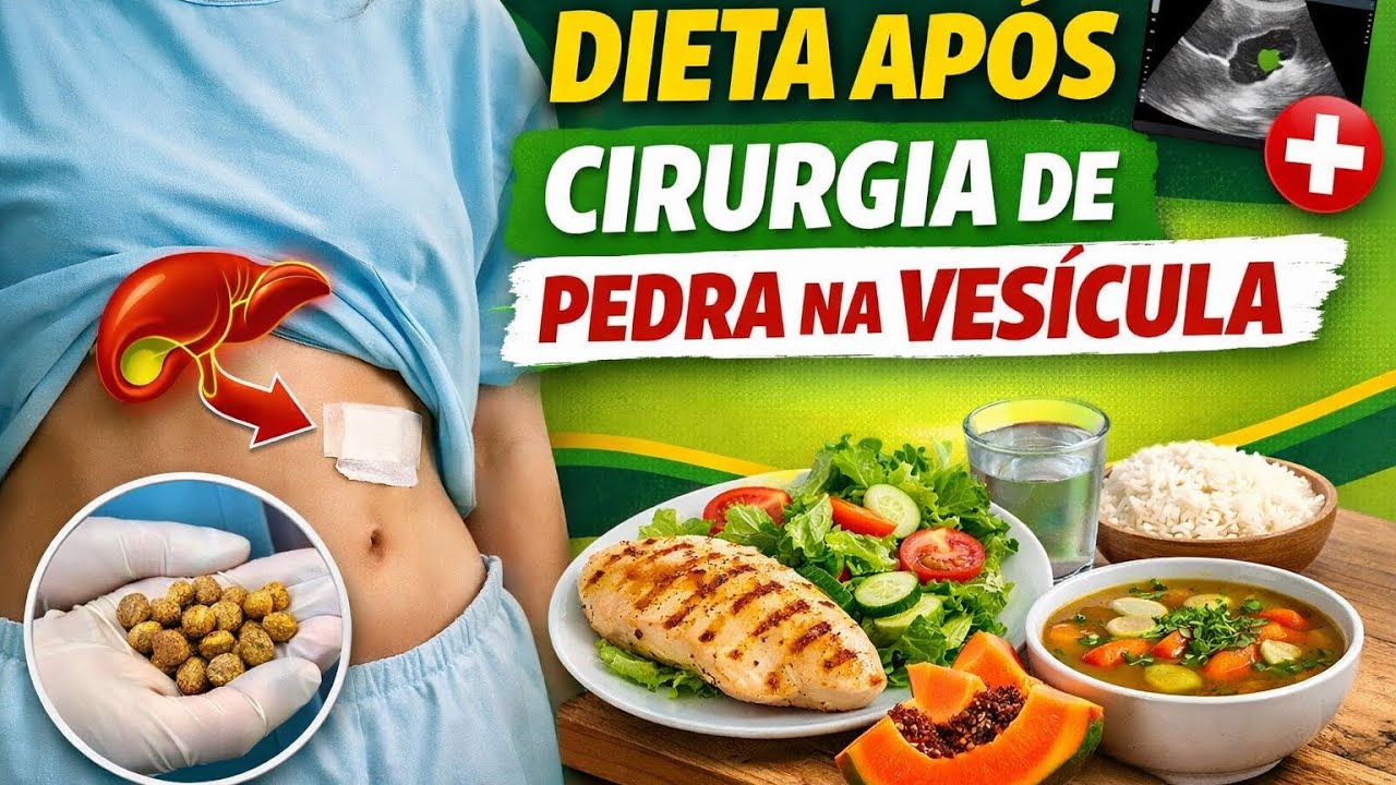 Dieta após cirugia de PEDRA NA VESÍCULA.