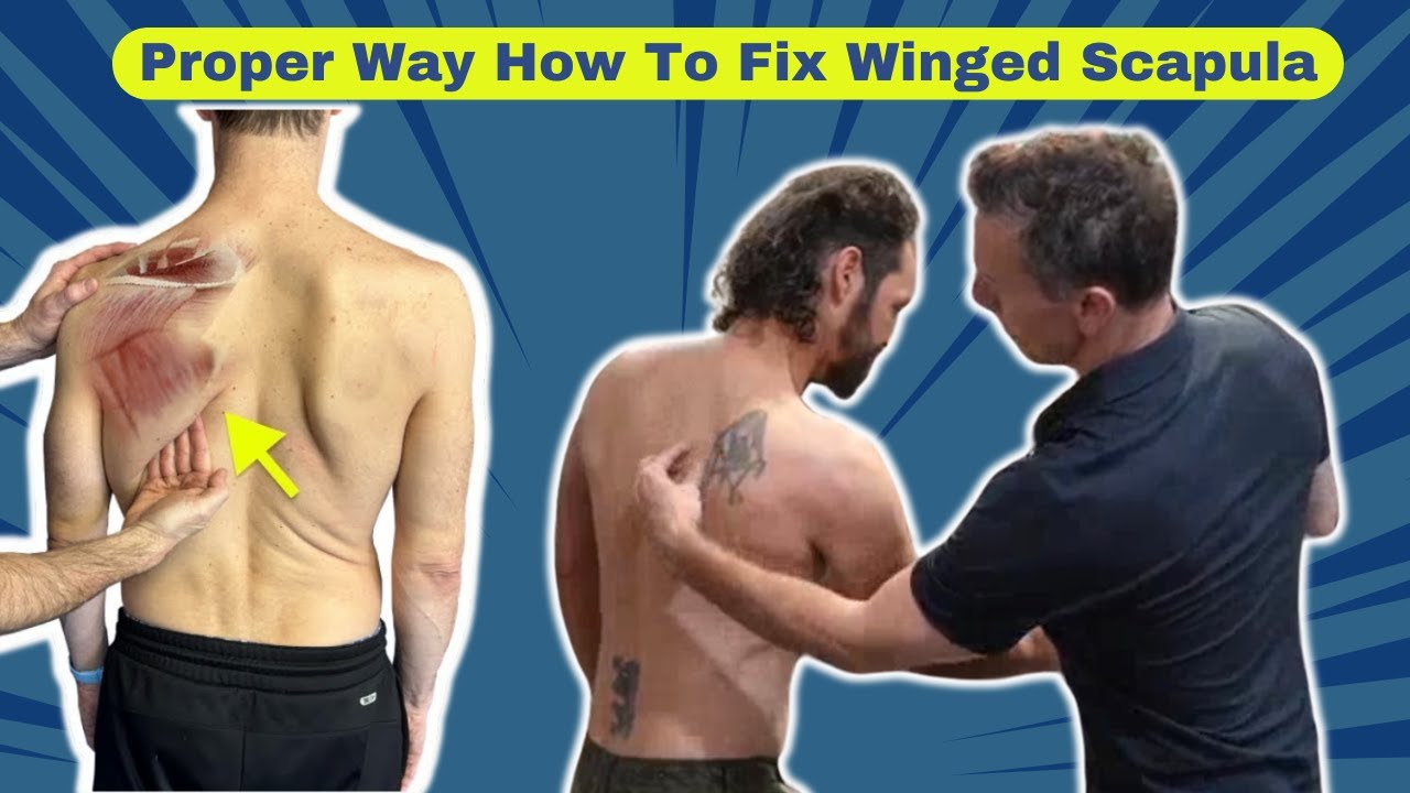 The Proper Way How to Fix Winged Scapula - Full Episode
