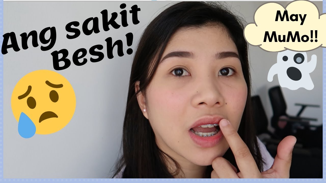 Braces Update: 5th Adjustment | Pinakamasakit na Part after adjustment
