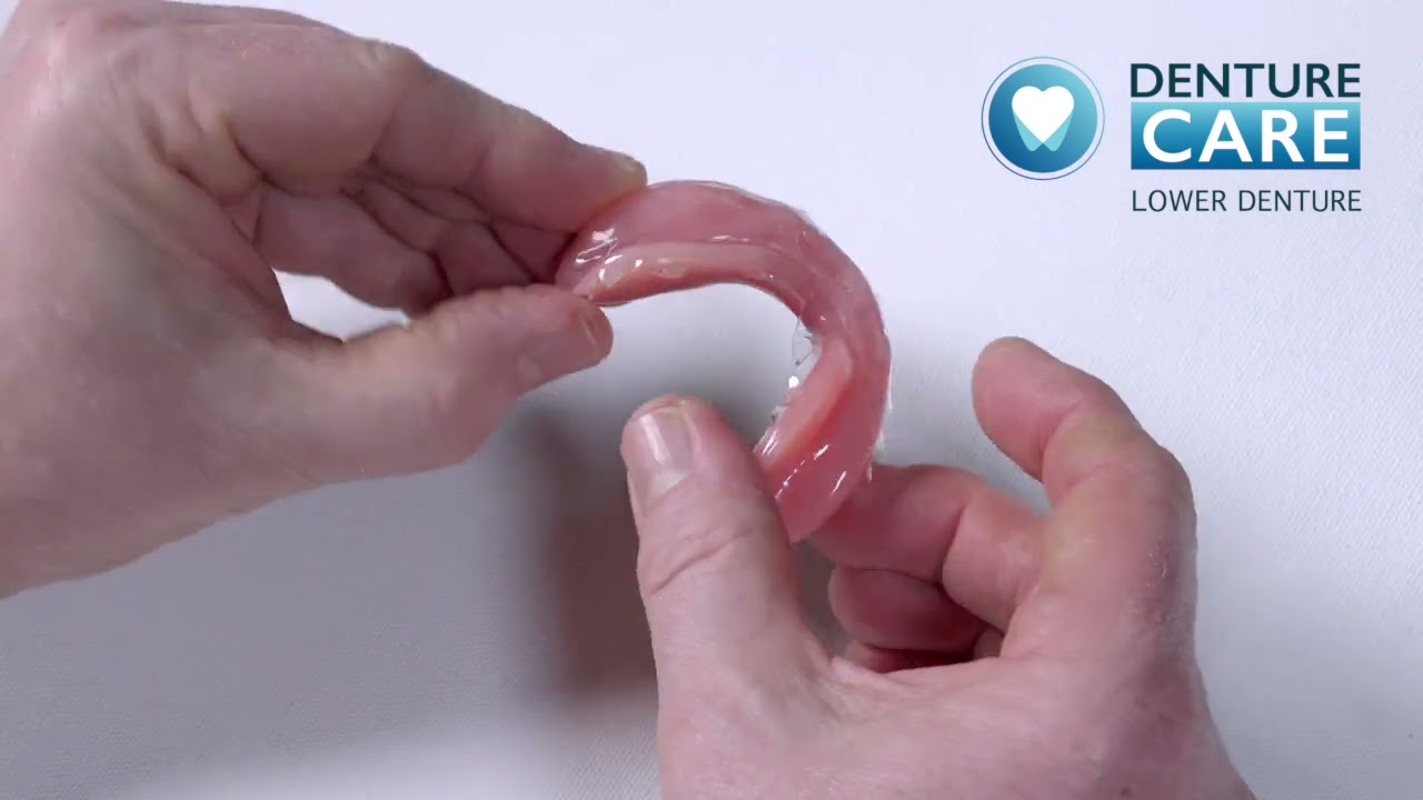 Lower denture  liner application