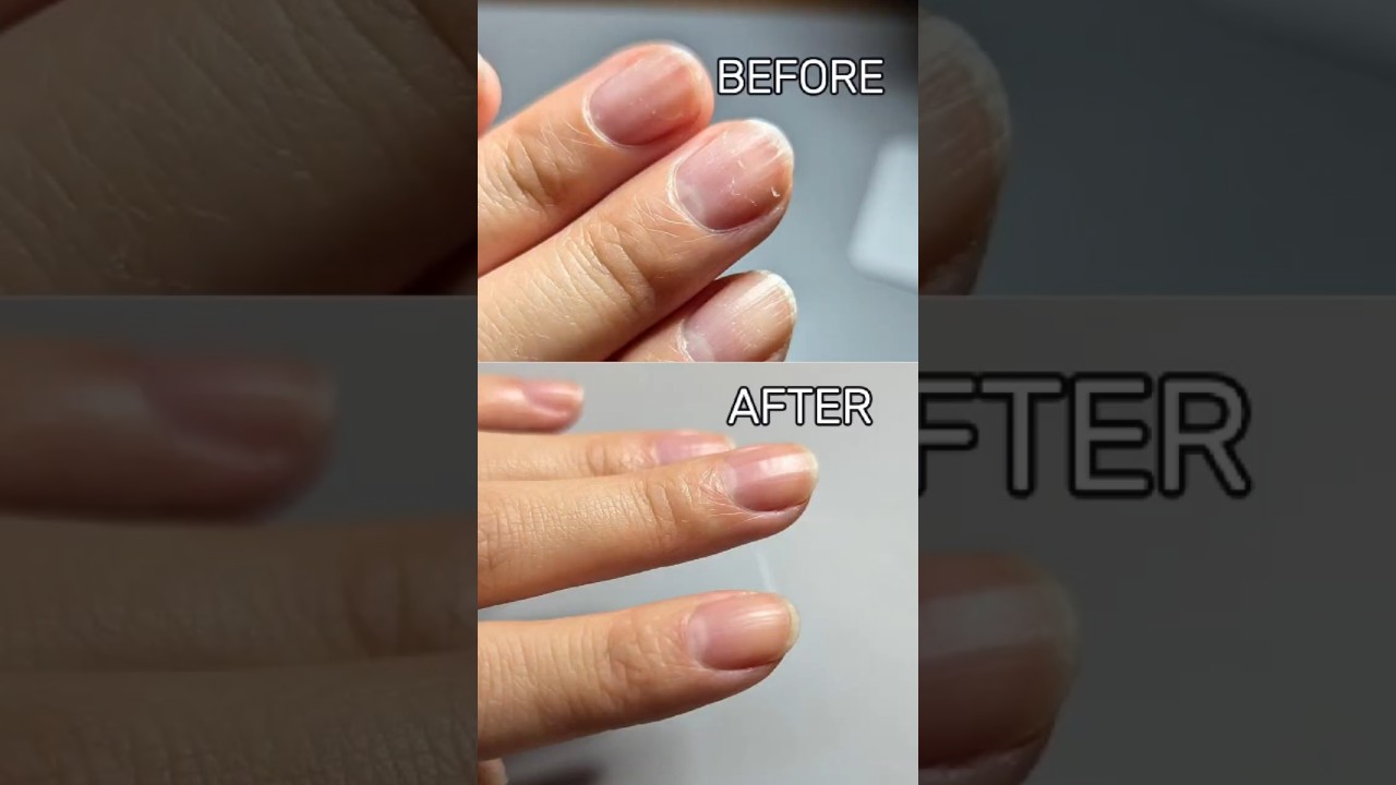 how I repaired my damaged nails! top 5 tips & tricks #nails #nailart #nailpolish #beauty #shorts