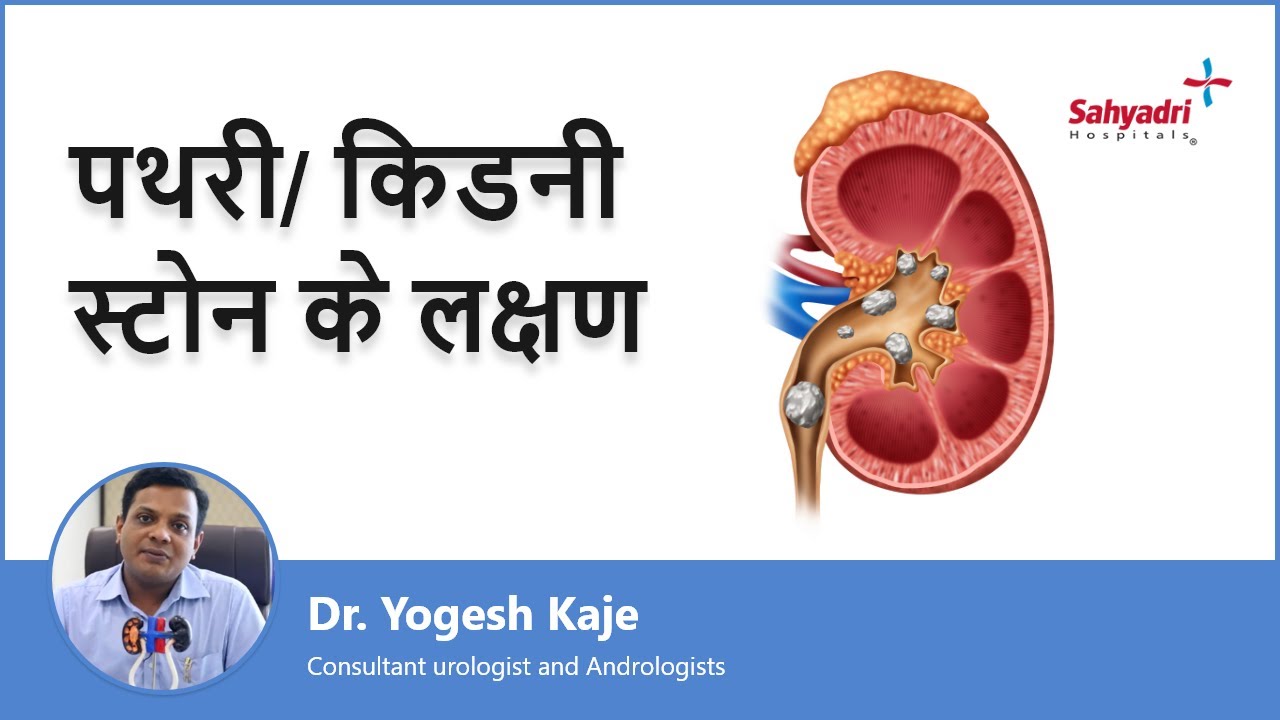 पथरी/ किडनी स्टोन के लक्षण | Signs And Symptoms Of Kidney Stone in Hindi |Dr. Yogesh Kaje | Sahyadri