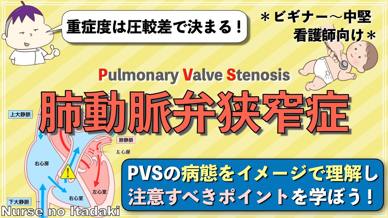 【肺動脈弁狭窄症とは？】病態をイメージで理解し､臨床でのポイントを学ぼう！