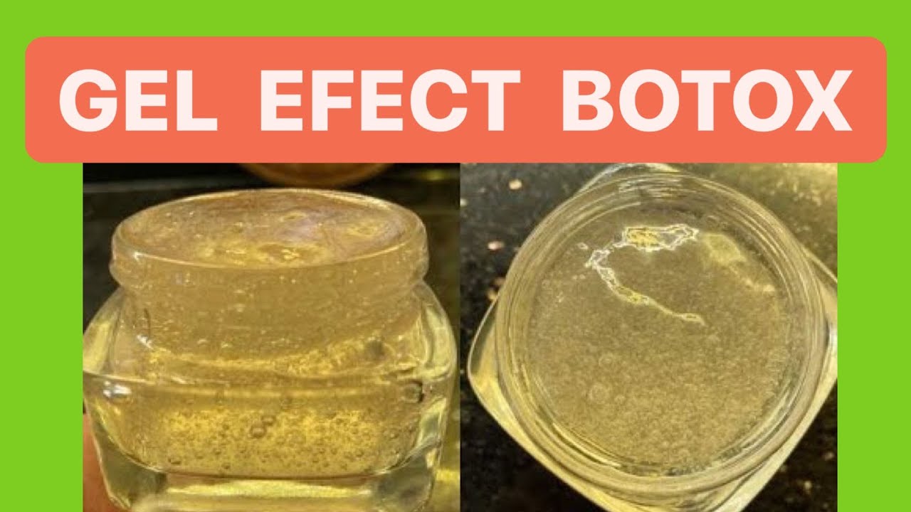 GEL BOTOX natural antiriduri. CREMA ANTIRID cu efect rapid