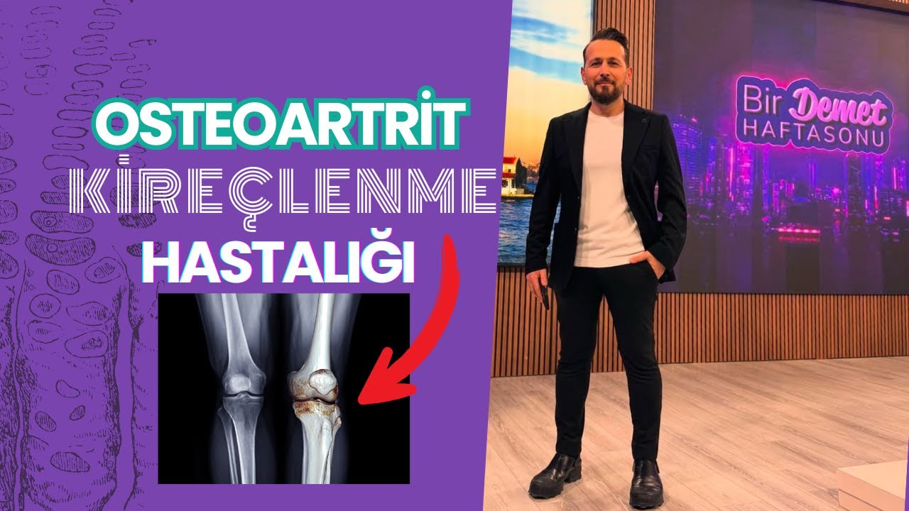 Kireçlenme Hastalığı Osteoartrit Nedir?  Bir Demet Hafta Sonu