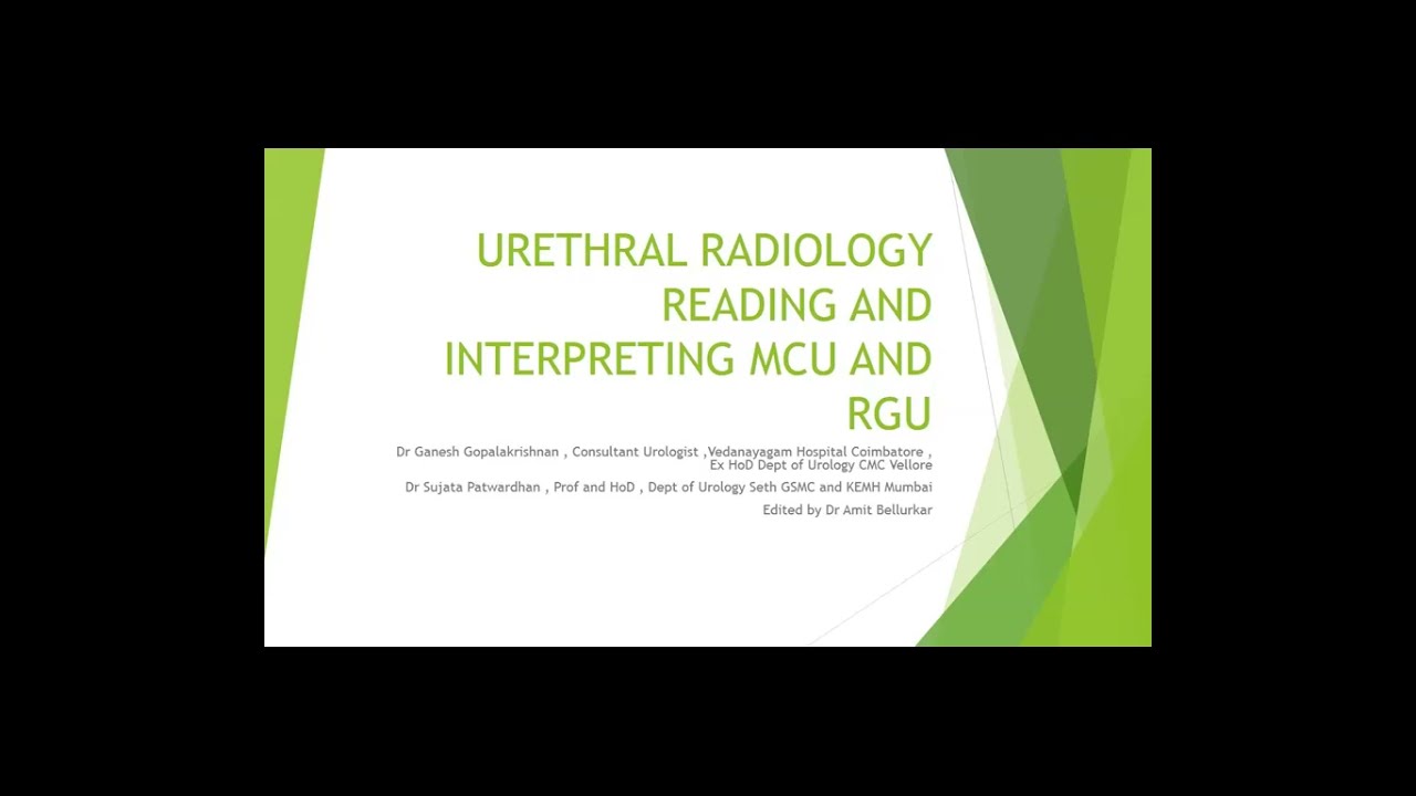 How to read MCU and RGU Part 1