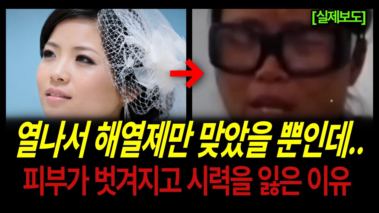 [중국실화] 해열제 주사 맞고 피부가 벗겨지고 시력을 잃은 여성