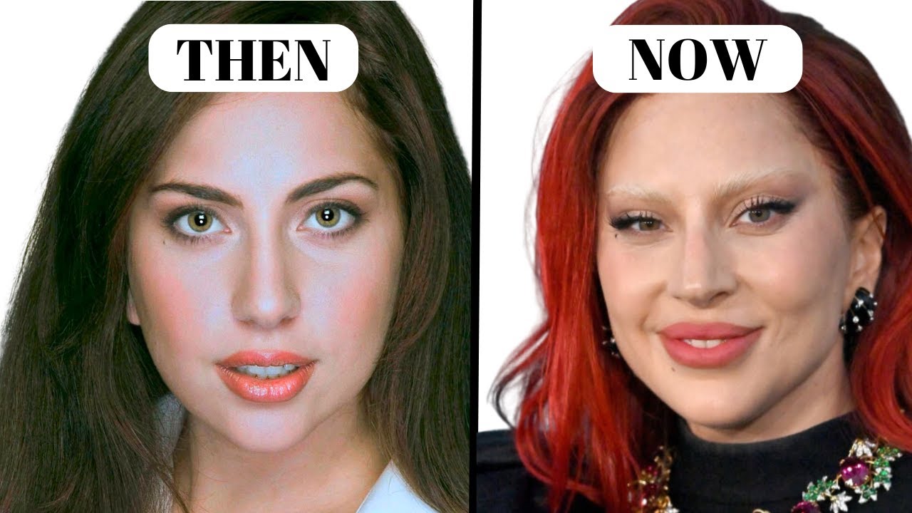 Lady Gaga&rsquo;s NEW LOOK | Plastic Surgeon Reacts