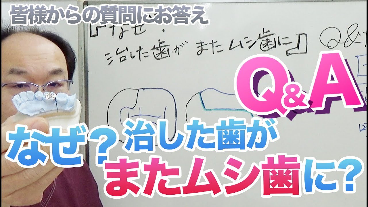 治した歯がまたむし歯になったのはなぜ？　和歌山の歯科【歯科医師解説】