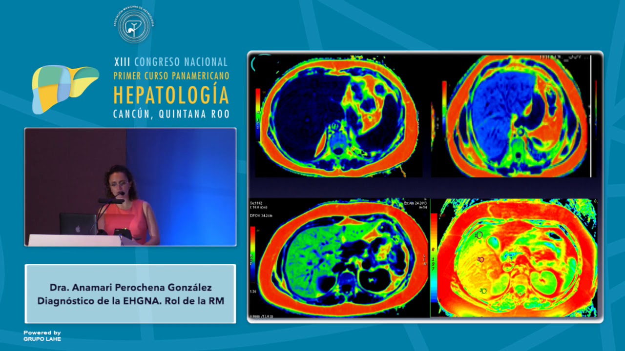 Módulo 2 - Diagnostico de la EHGNA. Rol de la RM
