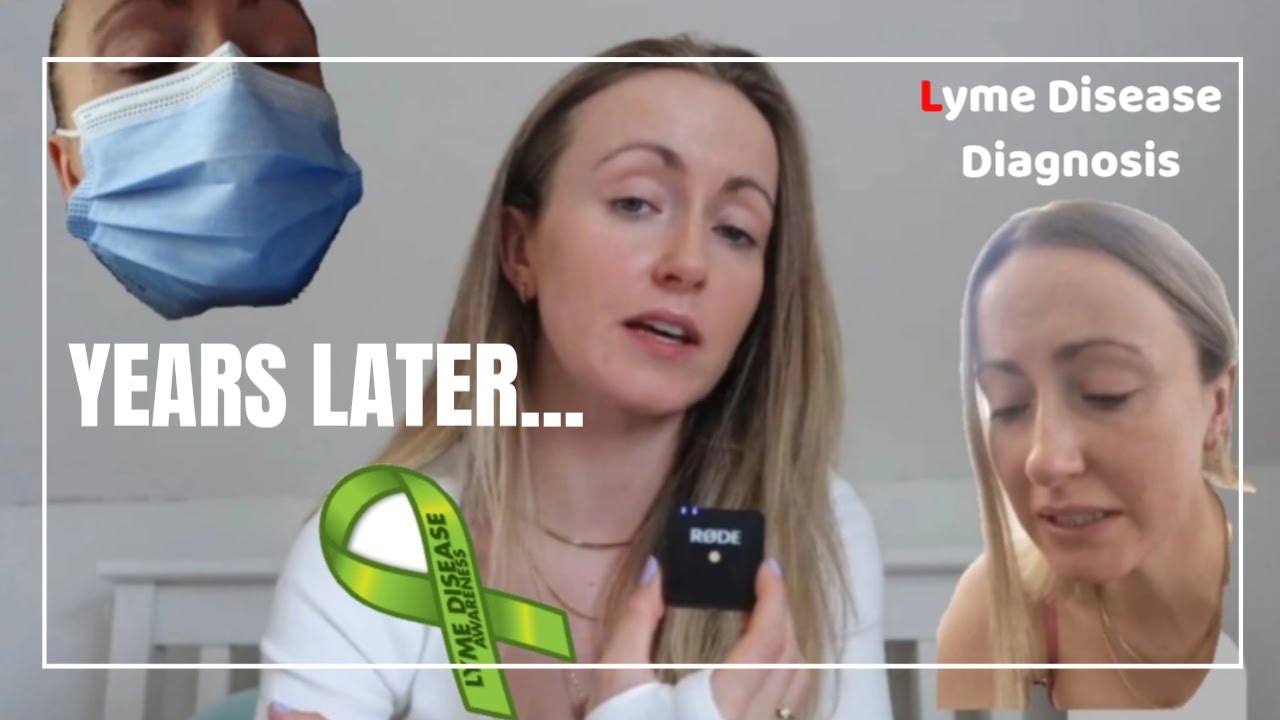 PPPD (My Lyme Diagnosis)