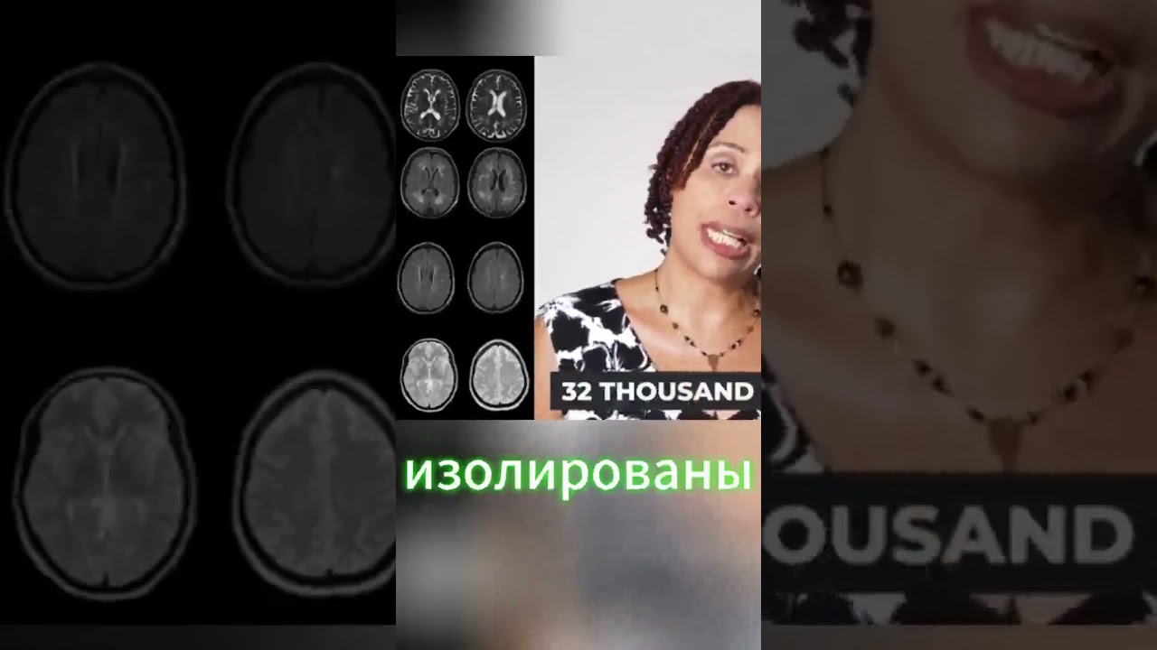 Что социальная изоляция делает с вашим мозгом — как исправить ущерб