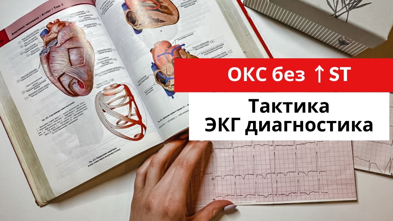 Инфаркт миокарда без подъема сегмента ST.  ЭКГ диагностика. Тактика. Часть 3.
