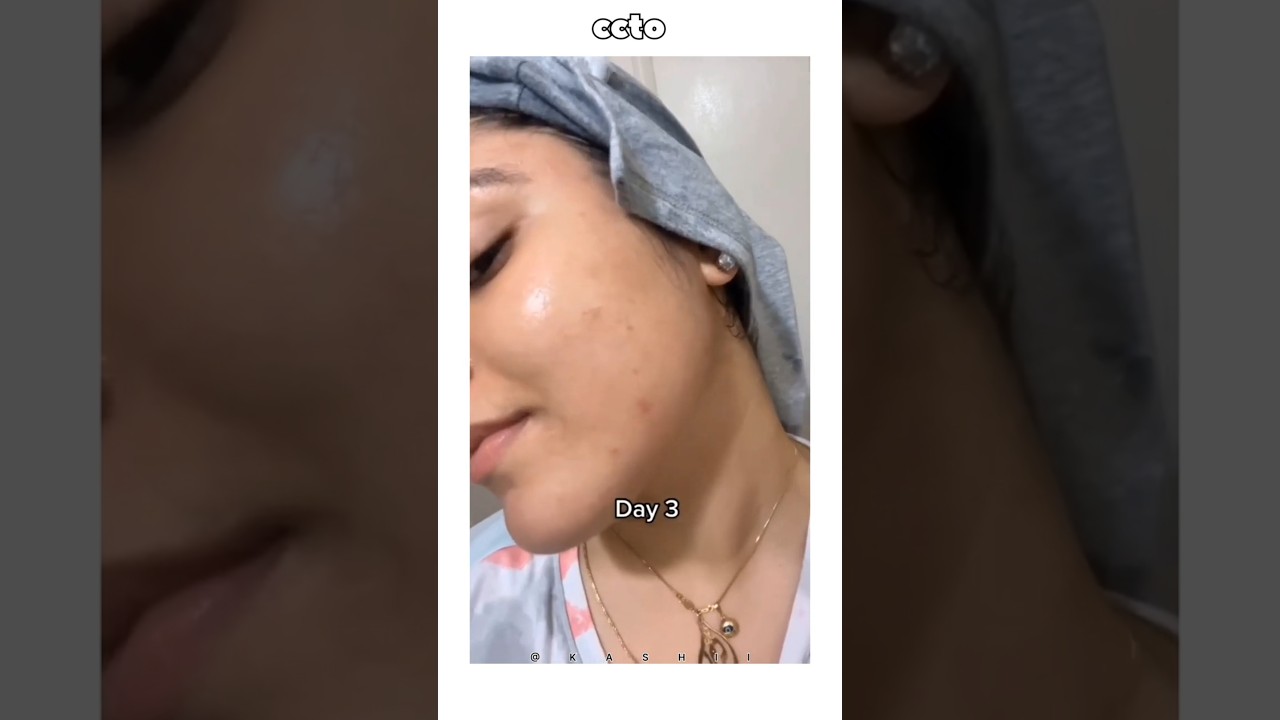 who to get clear skin 🤍#clearskinsecrets #astheticgirl #skincare #clearskin #glassskin