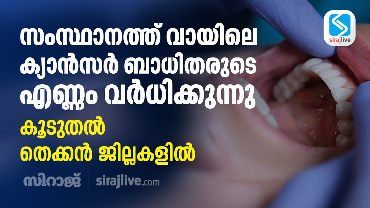 സംസ്ഥാനത്ത് വായിലെ ക്യാൻസർ ബാധിതരുടെ എണ്ണം വർധിക്കുന്നു; കൂടുതൽ തെക്കൻ ജില്ലകളിൽ | Oral Cancer