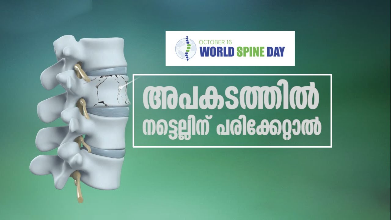 അപകടത്തിൽ  നട്ടെല്ലിന് പരിക്കേറ്റാൽ | Handle Spinal Injury | Malayalam