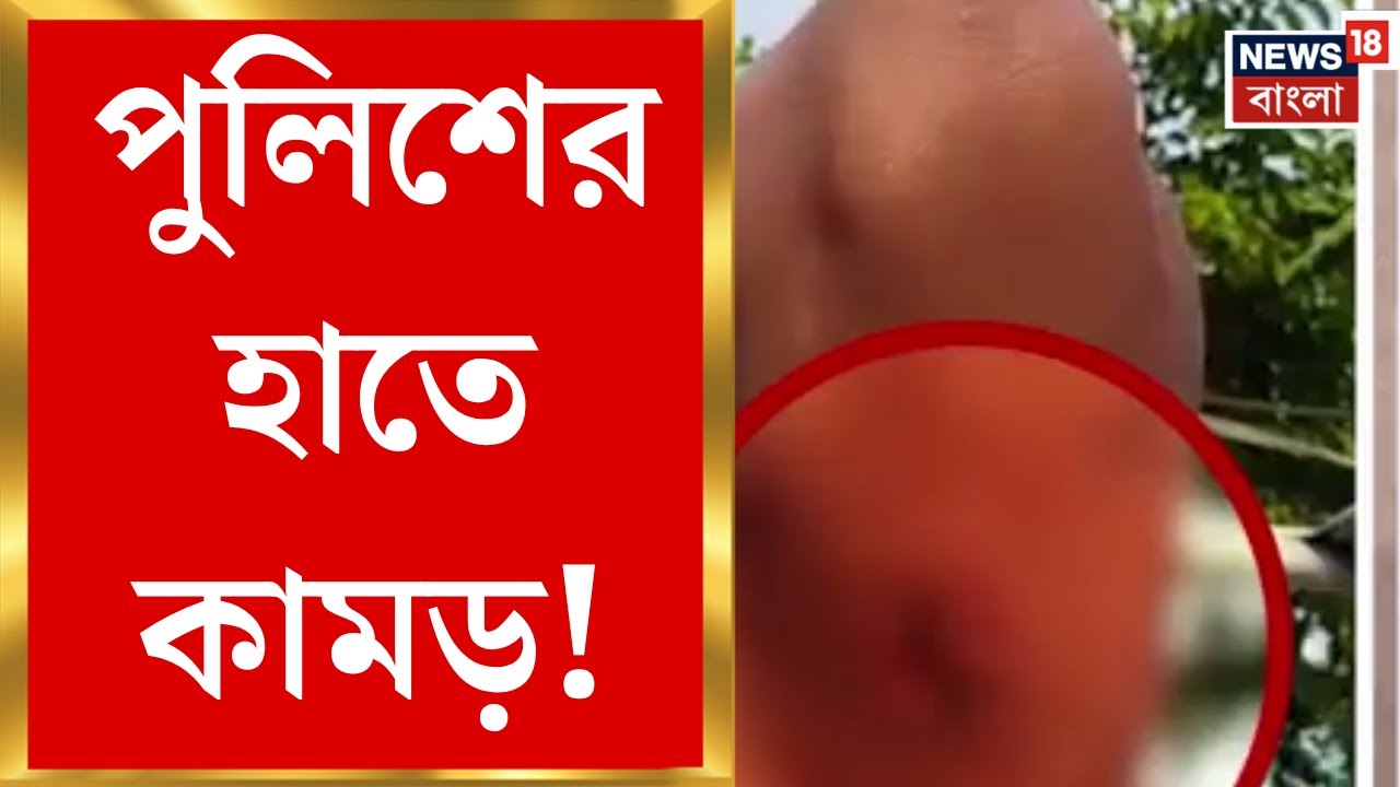 South 24 Pargana News | Bhangar-এ বেআইনি নির্মাণ রুখতে পুলিশের হাতে কামড়, আহত কনস্টেবল| Bangla News