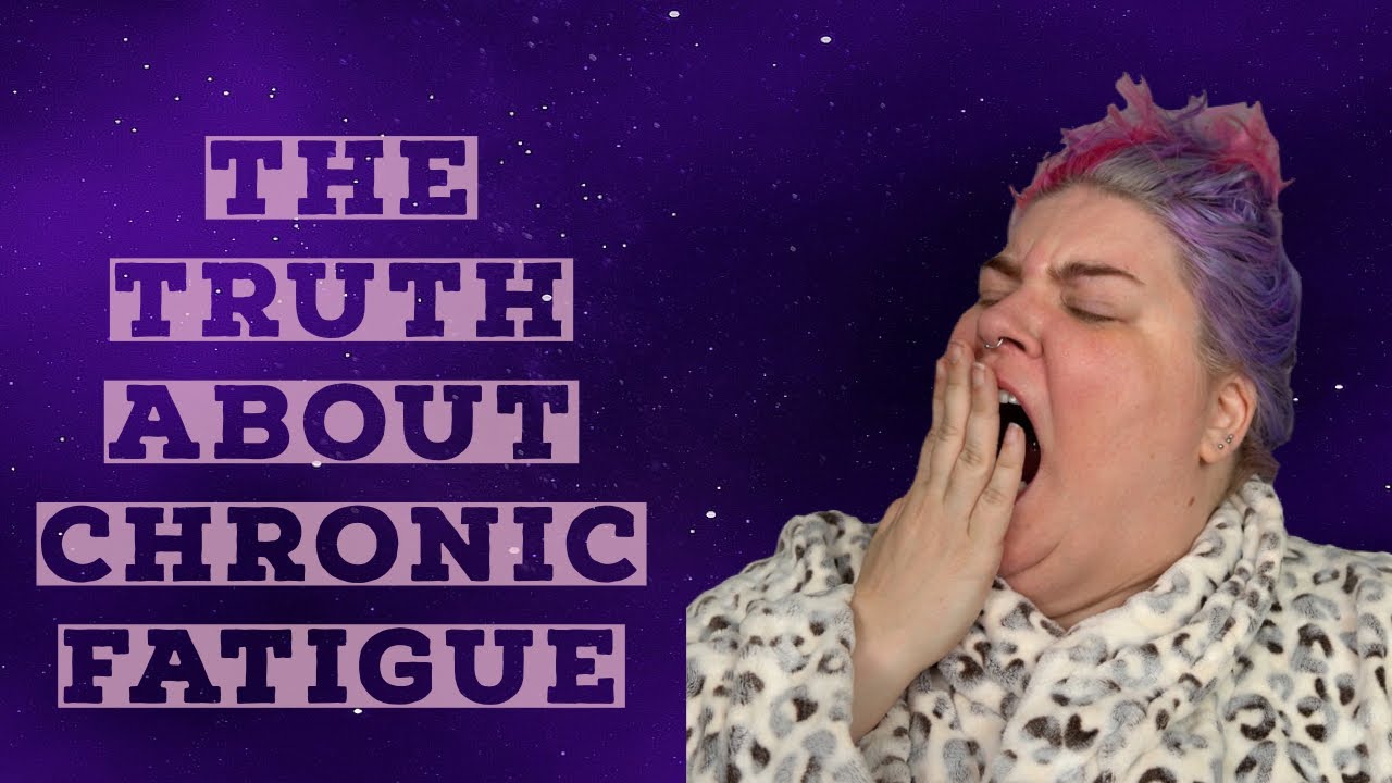 My Experience With Chronic Fatigue (Narcolepsy Type 2)