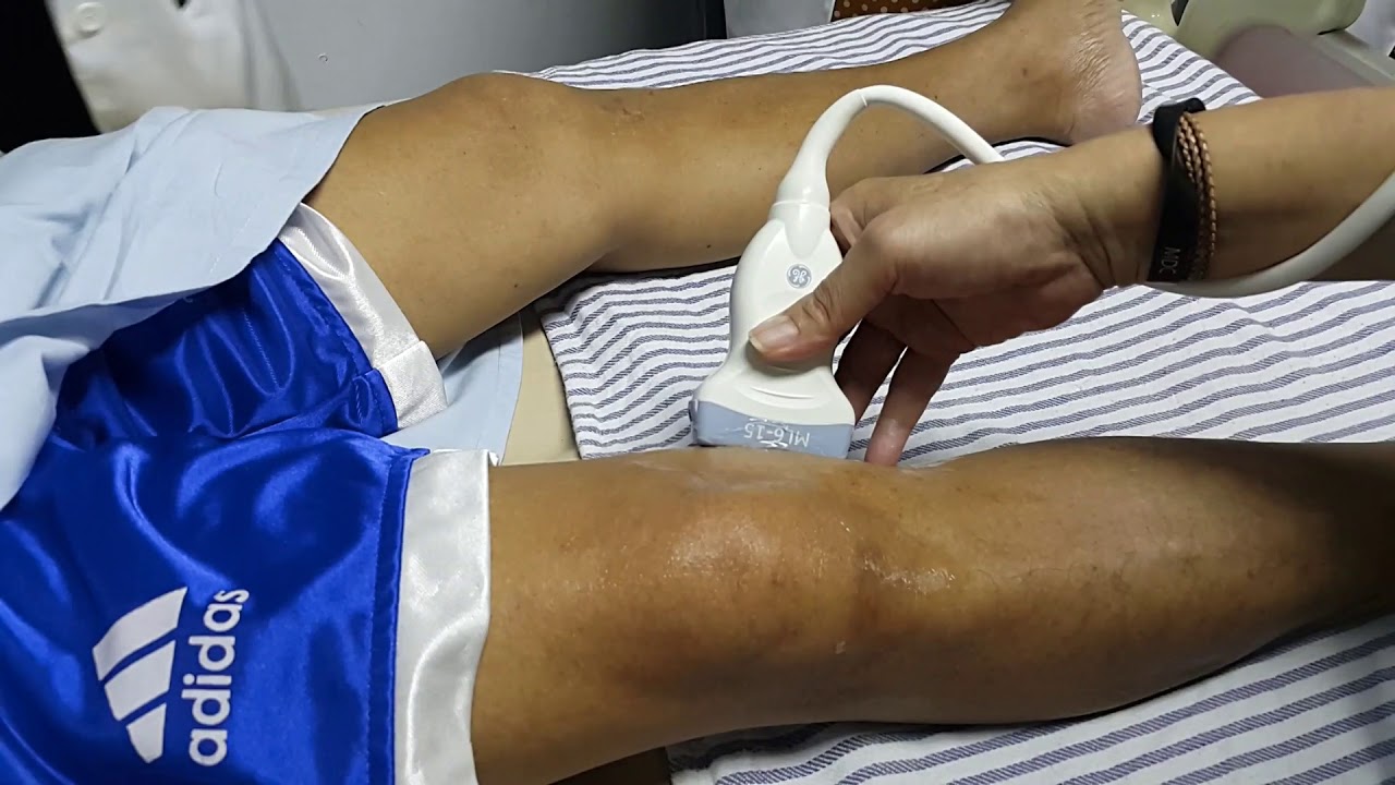 USG KNEE