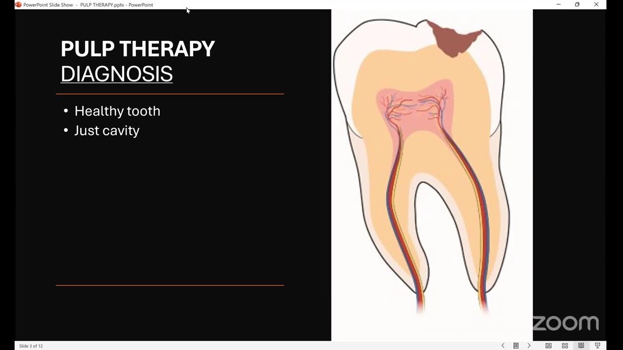 DR. Joyce success story and vitality pulp therapy