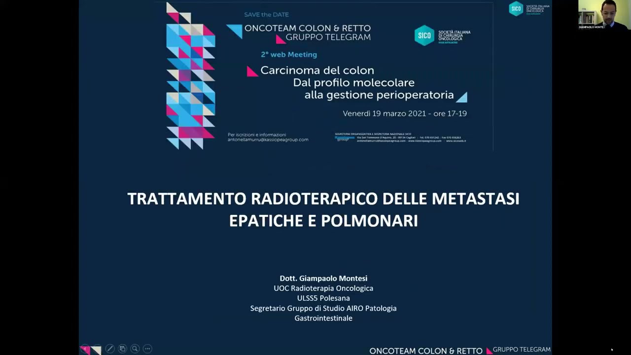 Trattamento radioterapico delle metastasi epatiche e polmonari