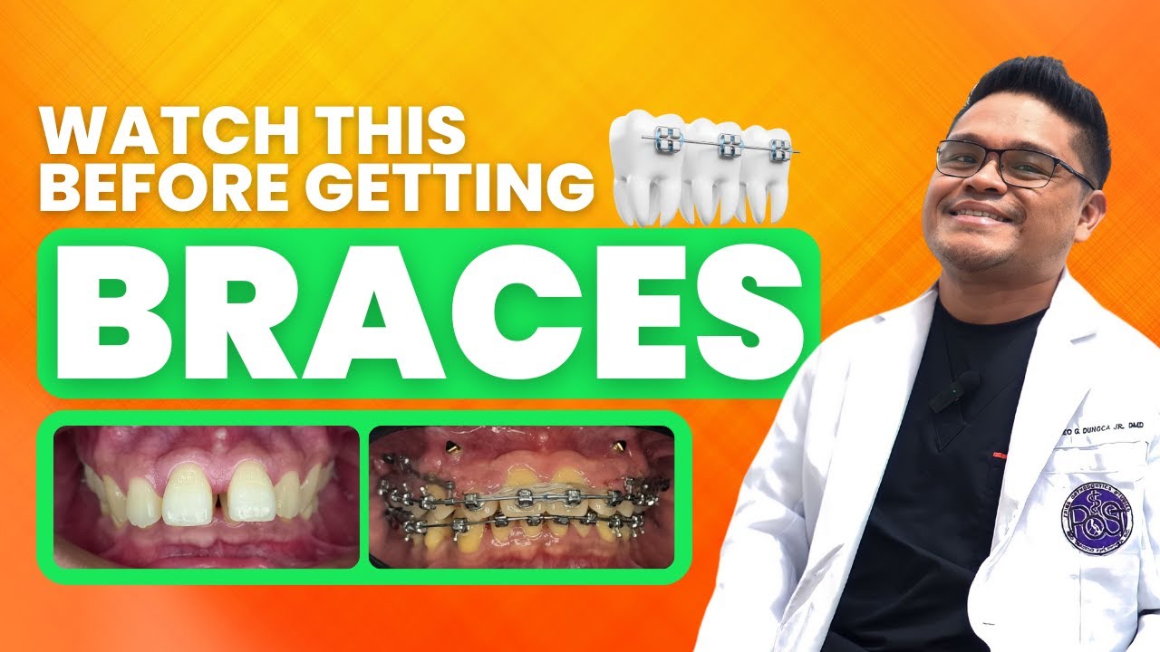Urban Smiles Dental Clinic Teeth Talk Episode 4: Orthodontics