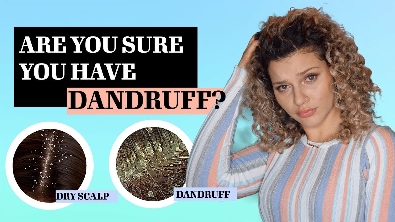 THE DIFFERENCE BETWEEN DANDRUFF VS DRY SCALP + TREATMENTS