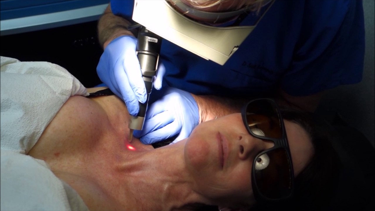 PicoSure® Laser Skin Rejuvenation Video